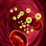 Hipertrigliceridemia, una herencia familiar que aumenta la grasa en sangre y puede afectar el corazón La hipertrigliceridemia afecta a su corazón