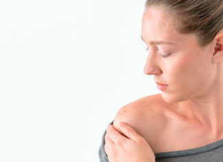 Cómo controlar los lunares para evitar el cáncer de piel