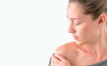 Cómo controlar los lunares para evitar el cáncer de piel