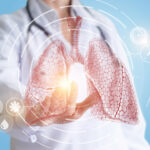 Neumonía: qué es y cómo preservar la salud pulmonar