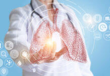 Neumonía: qué es y cómo cuidar tu salud pulmonar