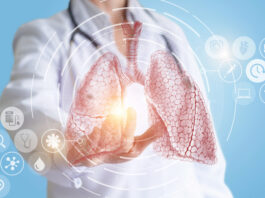 Neumonía: qué es y cómo cuidar tu salud pulmonar