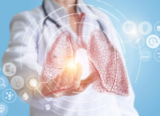 Neumonía: qué es y cómo preservar la salud pulmonar