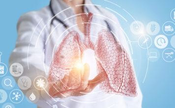 Neumonía: qué es y cómo preservar la salud pulmonar