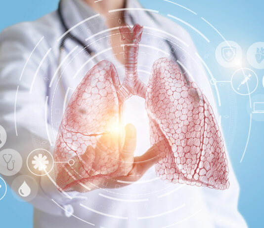 Neumonía: qué es y cómo cuidar tu salud pulmonar