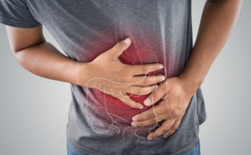 Las claves más exitosas para detectar y prevenir el cáncer de colon
