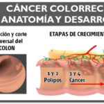 cancerdecolonb-foto2-anatomia