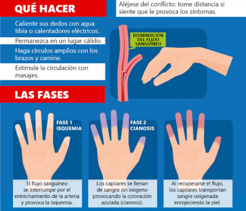 Raynaud, la enfermedad del frío y los dedos azules que afecta más a las ...