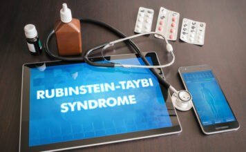 Qué es y cómo afecta el síndrome de Rubinstein–Taybi