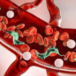 Todo lo que tenés que saber sobre el Mal de Chagas-Mazza