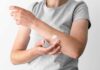 Según expertos, ¿Cómo la dermatitis atópica impacta en el descanso y el bienestar?
