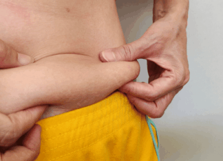 Después de los 45: qué explica la aparición de los “rollitos” abdominales