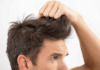 El pelo como espejo del organismo: qué señales pueden alertar sobre tu salud