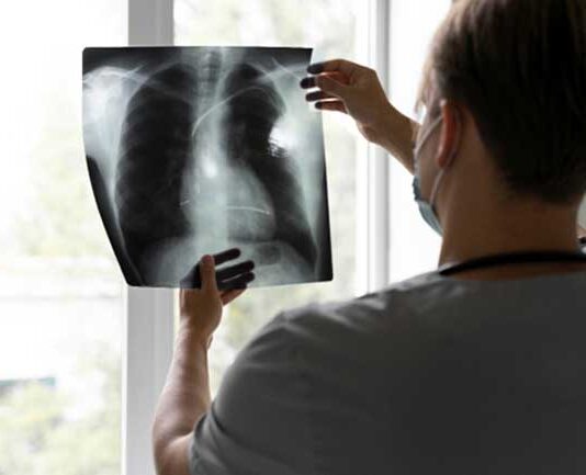 Neumonía:Neumonía: ¿Qué es, cómo detectarla y cómo prevenirla?Neumonía: