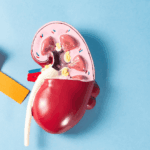 Cáncer renal: una enfermedad que muchas veces se descubre por casualidad