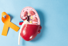 Cáncer renal: una enfermedad que muchas veces se descubre por casualidad